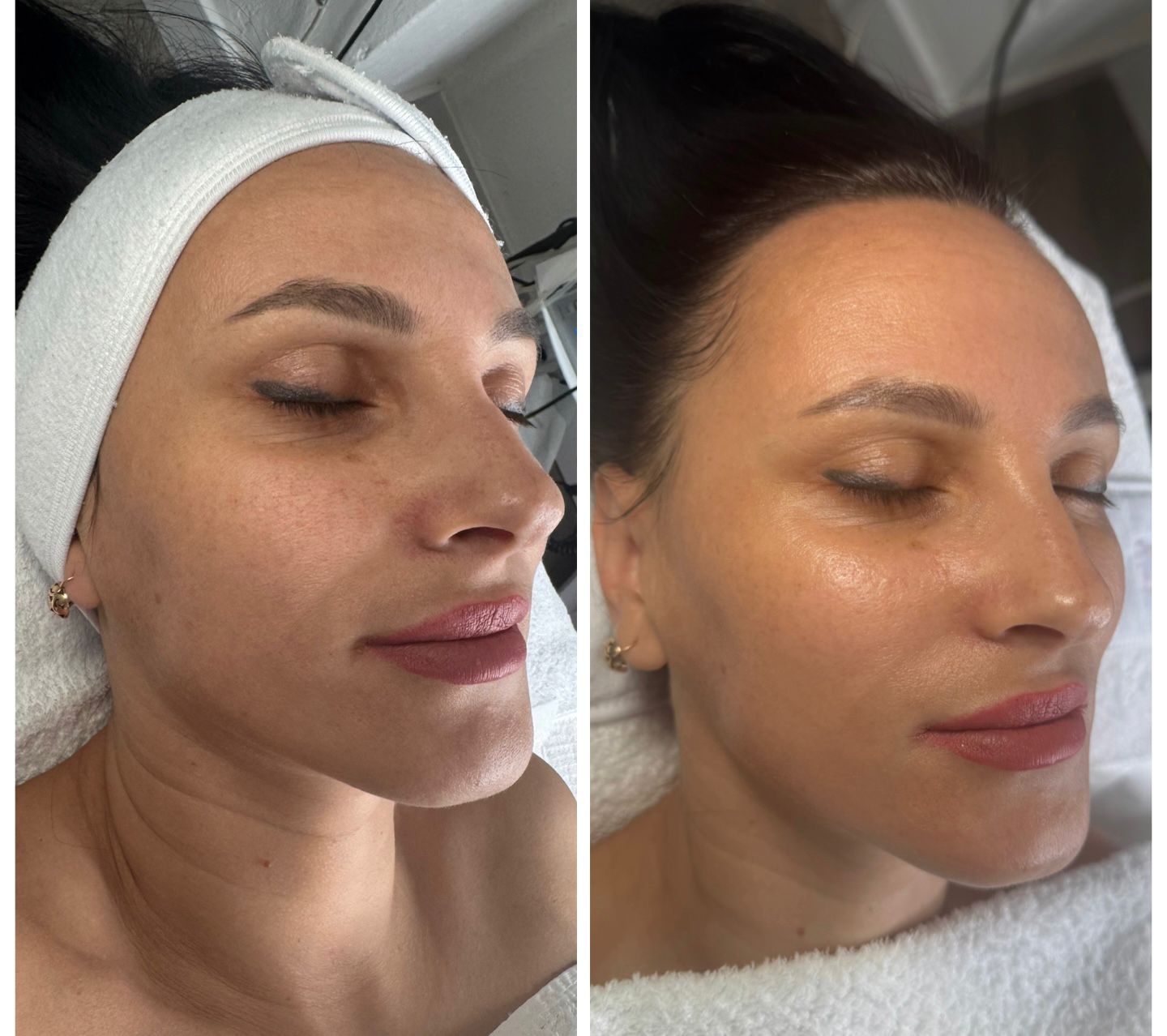 Signature deep cleanse facials in West Kensington