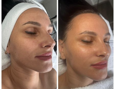 Signature deep cleanse facials in West Kensington